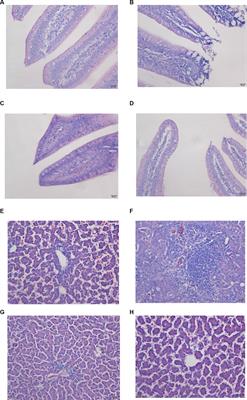 Effects of nano-selenium on cecum microbial community and metabolomics in chickens challenged with Ochratoxin A